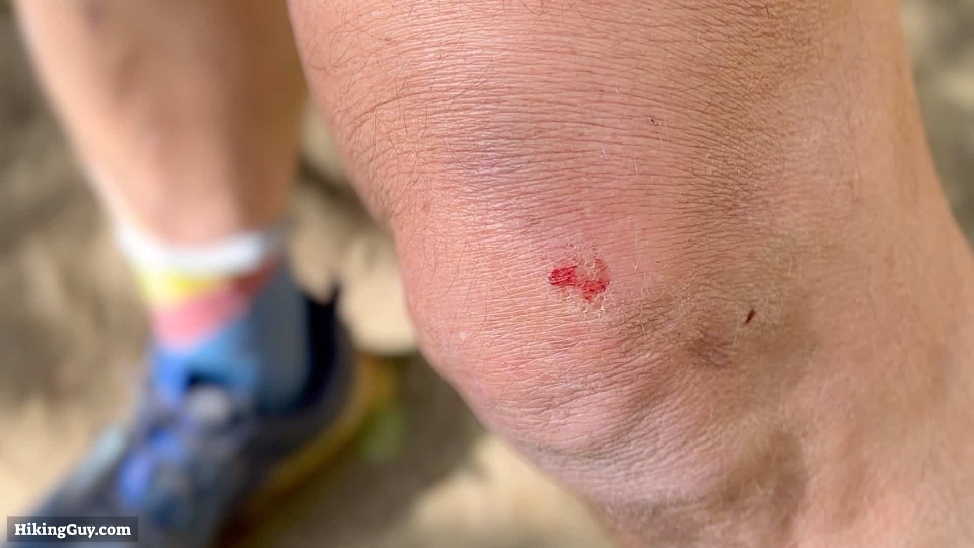 Black Star Canyon Falls Sratched Leg